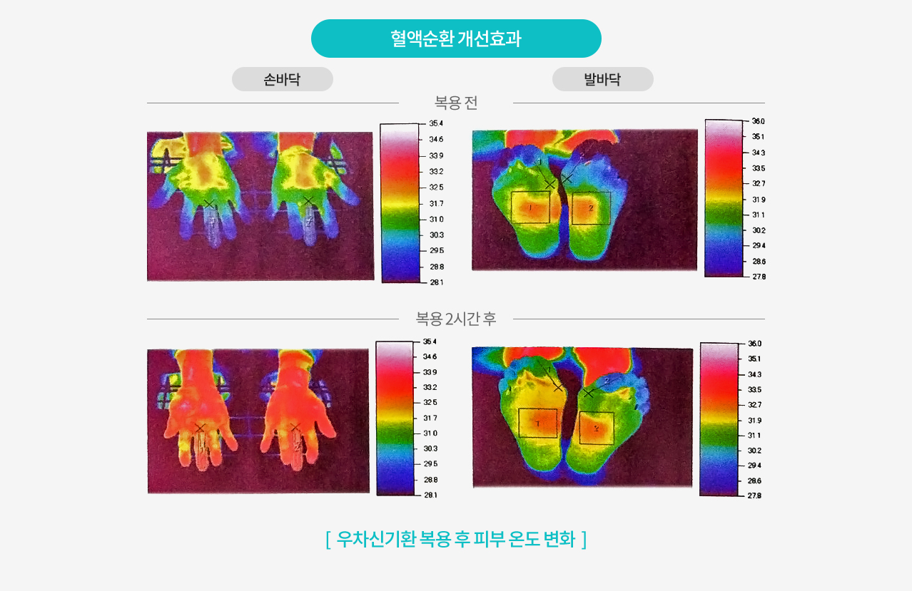 혈액순환 개선효과 / [  우차신기환 복용 후 피부 온도 변화  ]